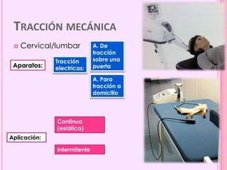 ¿Cuáles son las técnicas de tracción?