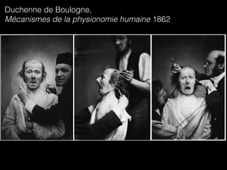 Duchenne de Boulogne, 
Mécanismes de la physionomie humaine 1862
 