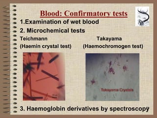 20
Blood: Confirmatory tests
1.Examination of wet blood
2. Microchemical tests
Teichmann Takayama
(Haemin crystal test) (Haemochromogen test)
3. Haemoglobin derivatives by spectroscopy
 