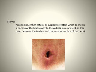 Stoma:
An opening, either natural or surgically created, which connects
a portion of the body cavity to the outside environment (in this
case, between the trachea and the anterior surface of the neck).
 