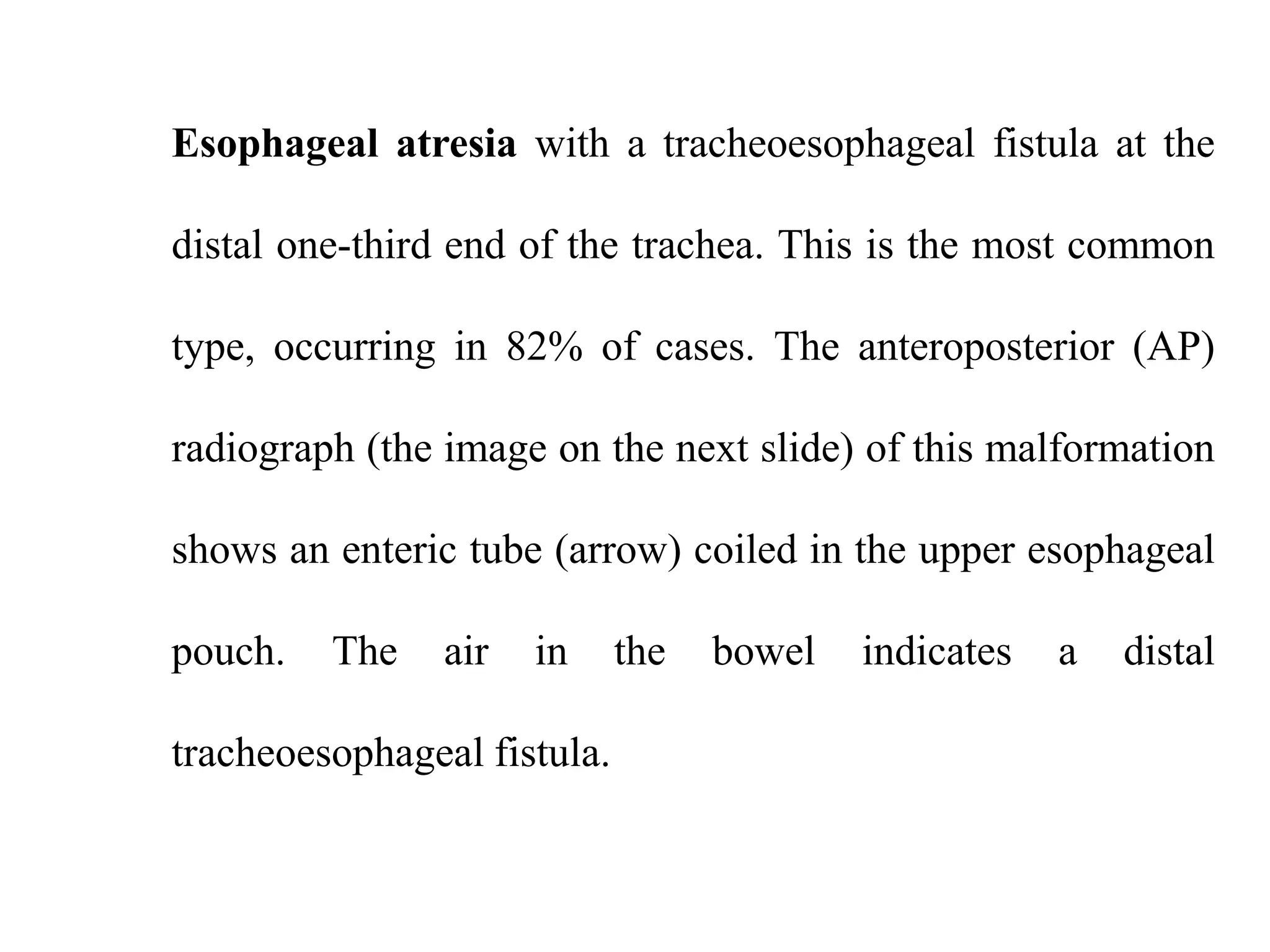 Esophageal atresia with a tracheoesophageal fistula at the
distal one-third end of the trachea. This is the most common

type, occurring in 82% of cases. The anteroposterior (AP)
radiograph (the image on the next slide) of this malformation
shows an enteric tube (arrow) coiled in the upper esophageal
pouch.

The

air

in

tracheoesophageal fistula.

the

bowel

indicates

a

distal

 