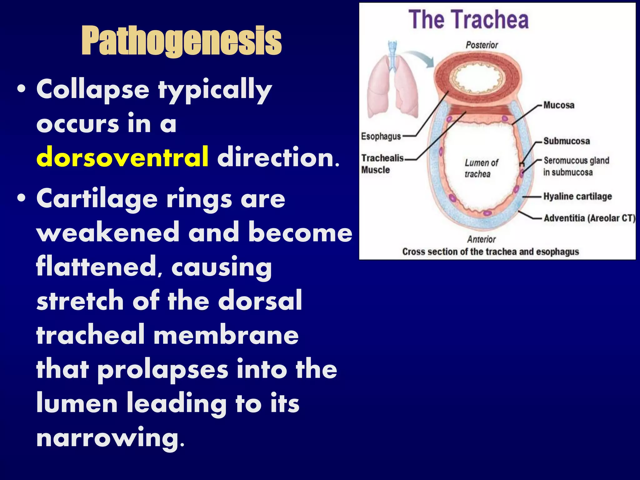 Pathogenesis
• Collapse typically
occurs in a
dorsoventral direction.
• Cartilage rings are
weakened and become
flattened, causing
stretch of the dorsal
tracheal membrane
that prolapses into the
lumen leading to its
narrowing.
 