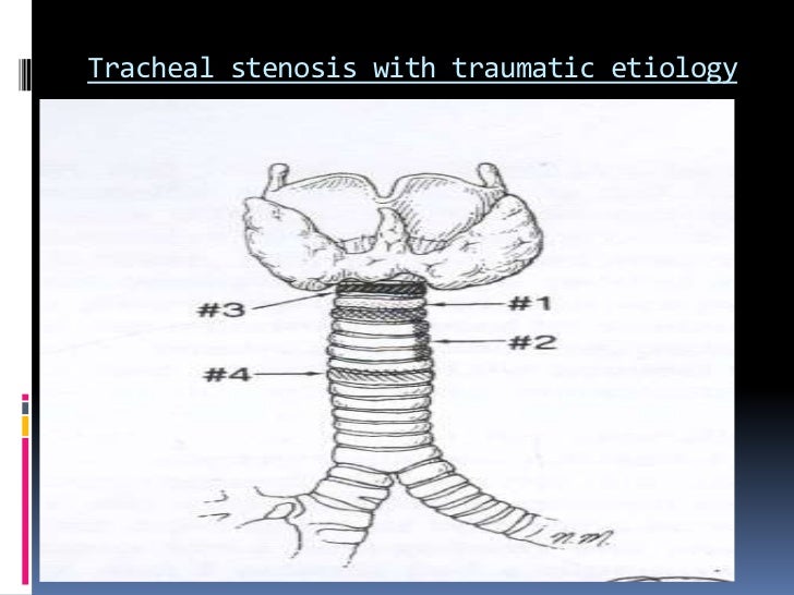 Tracheobroncial reconstruction final