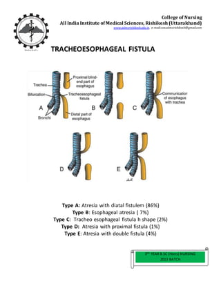 TRACHEOESOPHAGEAL FISTULA
Type A: Atresia with diatal fistulem (86%)
Type B: Esophageal atresia ( 7%)
Type C: Tracheo esophageal fistula h shape (2%)
Type D: Atresia with proximal fistula (1%)
Type E: Atresia with double fistula (4%)
3RD
YEAR B.SC (Hons) NURSING
2013 BATCH
College of Nursing
All India Institute of Medical Sciences, Rishikesh (Uttarakhand)
www.aiimsrishikesh.edu.in, e-mail:con.aiimsrishikesh@gmail.com
 