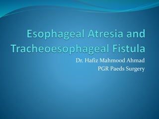 Dr. Hafiz Mahmood Ahmad
PGR Paeds Surgery
 