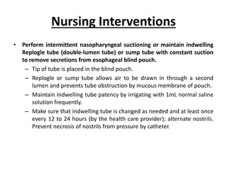 Tracheoesophageal fistula | PPTX