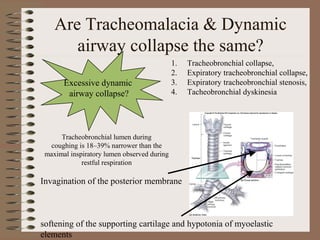 Are Tracheomalacia & Dynamic
airway collapse the same?
Excessive dynamic
airway collapse?

1.
2.
3.
4.

Tracheobronchial collapse,
Expiratory tracheobronchial collapse,
Expiratory tracheobronchial stenosis,
Tacheobronchial dyskinesia

Tracheobronchial lumen during
coughing is 18–39% narrower than the
maximal inspiratory lumen observed during
restful respiration

Invagination of the posterior membrane

softening of the supporting cartilage and hypotonia of myoelastic
elements

 