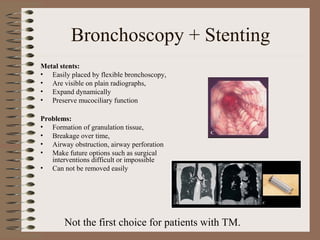 Bronchoscopy + Stenting
Metal stents:
• Easily placed by flexible bronchoscopy,
• Are visible on plain radiographs,
• Expand dynamically
• Preserve mucociliary function
Problems:
• Formation of granulation tissue,
• Breakage over time,
• Airway obstruction, airway perforation
• Make future options such as surgical
interventions difficult or impossible
• Can not be removed easily

Not the first choice for patients with TM.

 