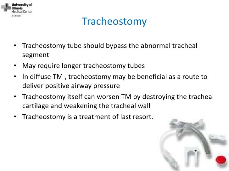 Dynamic Central Airway Obstruction Tracheomalacia, Tracheobronchomal…