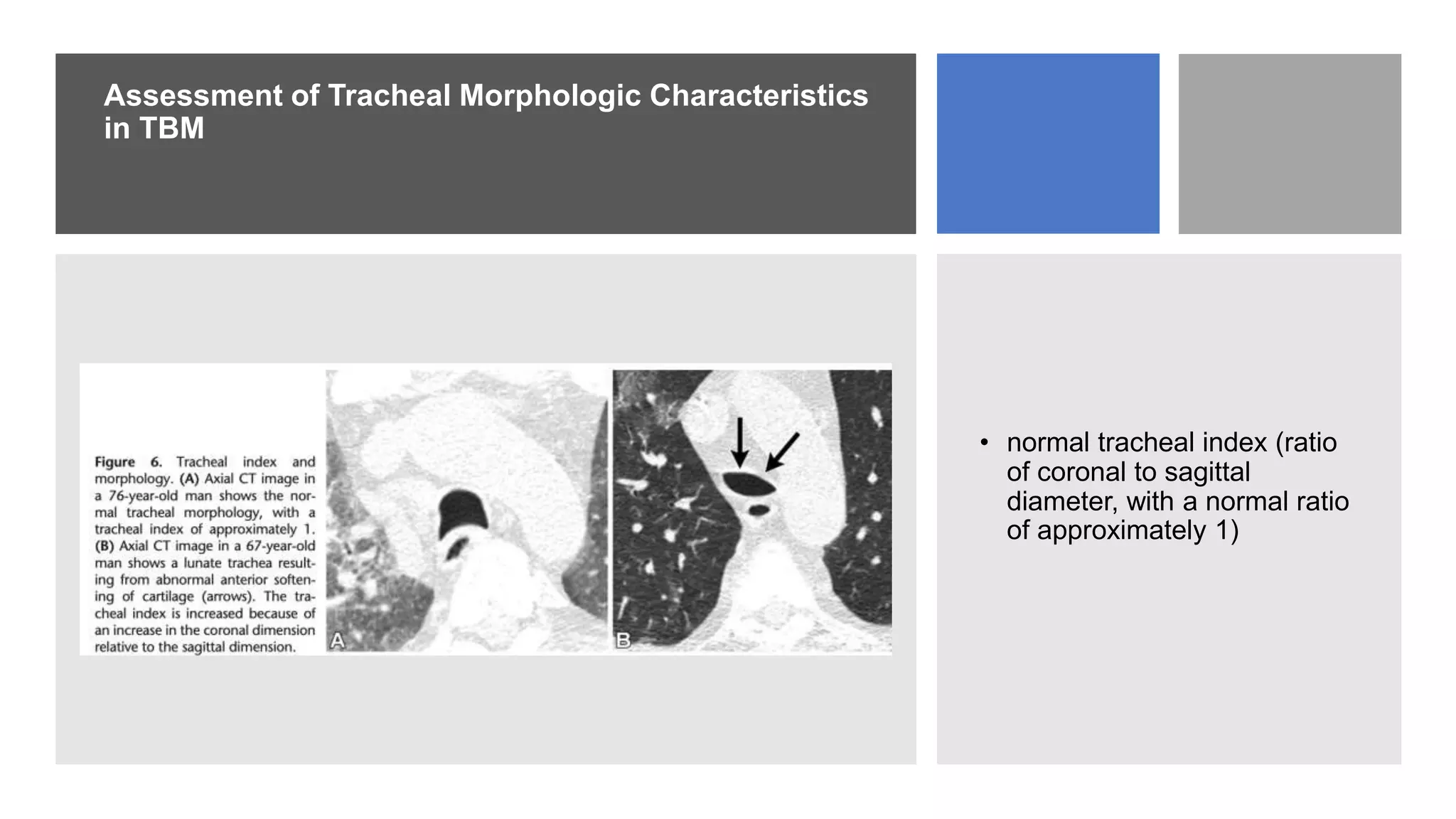 tracheomalcia and edac.pptx