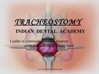TRACHEOSTOMY
INDIAN DENTAL ACADEMY
Leader in continuing dental education
www.indiandentalacademy.com

www.indiandentalacademy.com

 