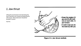 1. Jaw thrust 
Lifting the jaw forward and extending the 
neck improves the airway by displacing the 
soft tissues. Neck extension should be 
avoided in spinal 
injuries. 
 
