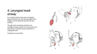 4. Laryngeal mask 
airway 
It is a device with a tube and a triangular 
distal end which fits over the laryngeal inlet . 
Oxygen can be delivered directly into the 
trachea. 
Though most commonly used for non-emergent 
airway control, it can be used as an 
alternative if standard mask ventilation is 
inadequate and 
intubation unsuccessful 
 