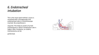 6. Endotracheal 
intubation 
This is the most rapid method. Larynx is 
visualised with a laryngoscope and 
endotracheal tube or a bronchoscope 
inserted. No anaesthesia is 
required. This helps to avoid a hurried 
tracheostomy in which complication rate is 
higher. After intubation, an orderly 
tracheostomy can be 
performed. 
 