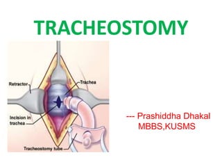 TRACHEOSTOMY 
--- Prashiddha Dhakal 
MBBS,KUSMS 
 