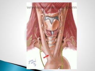TRACHEOSTOMY BY DR JUVERIA MAJEED MS ENT Slide 14