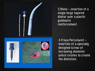 3.Rhino - insertion of a
single large tapered
dilator over a plastic
guidewire
reinforcement.
4.Frova Percutwist -
insertion of a specially
designed screw of
increasing diameter
which rotates to create
the dilatation.
 