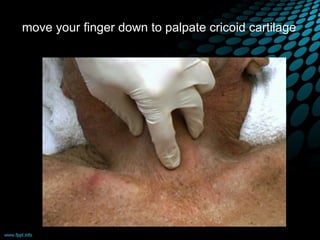 move your finger down to palpate cricoid cartilage
 
