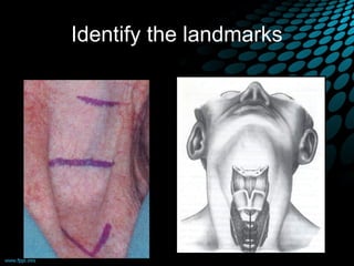 Identify the landmarks
 