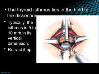 •The thyroid isthmus lies in the field of
the dissection.
• Typically, the
isthmus is 5 to
10 mm in its
vertical
dimension.
• Retract it up.
 