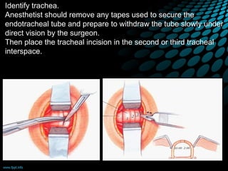 Identify trachea.
Anesthetist should remove any tapes used to secure the
endotracheal tube and prepare to withdraw the tube slowly under
direct vision by the surgeon.
Then place the tracheal incision in the second or third tracheal
interspace.
 