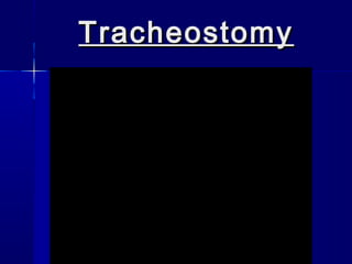 TracheostomyTracheostomy
 