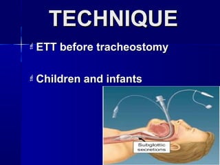 TECHNIQUETECHNIQUE
 ETT before tracheostomyETT before tracheostomy
 Children and infantsChildren and infants
 