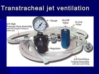 Transtracheal jet ventilationTranstracheal jet ventilation
 