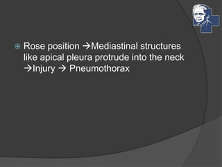  Rose position Mediastinal structures
like apical pleura protrude into the neck
Injury  Pneumothorax
 