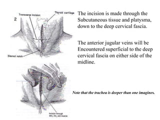 The incision is made through the
Subcutaneous tissue and platysma,
down to the deep cervical fascia.
The anterior jugular veins will be
Encountered superficial to the deep
cervical fascia on either side of the
midline.
Note that the trachea is deeper than one imagines.
 