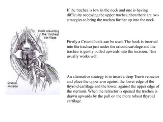 If the trachea is low in the neck and one is having
difficulty accessing the upper trachea, then there are two
strategies to bring the trachea further up into the neck.
Firstly a Cricoid hook can be used. The hook is inserted
into the trachea just under the cricoid cartilage and the
trachea is gently pulled upwards into the incision. This
usually works well.
An alternative strategy is to insert a deep Travis retractor
and place the upper arm against the lower edge of the
thyroid cartilage and the lower, against the upper edge of
the sternum. When the retractor is opened the trachea is
drawn upwards by the pull on the more robust thyroid
cartilage.
 
