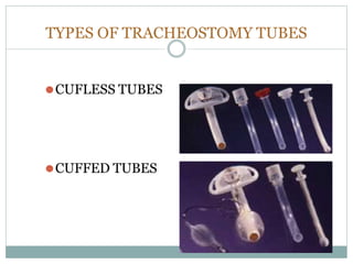 TYPES OF TRACHEOSTOMY TUBES
⚫CUFLESS TUBES
⚫CUFFED TUBES
 