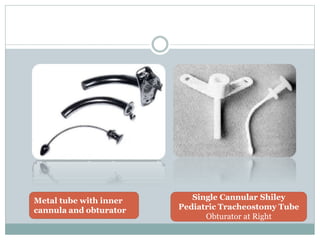 Metal tube with inner
cannula and obturator
Single Cannular Shiley
Pediatric Tracheostomy Tube
Obturator at Right
 
