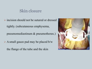 Skin closure
 incision should not be sutured or dressed
tightly. (subcutaneous emphysema,
pneumomediastinum & pneumothorax.)
 Asmall gauze pad may be placed b/w
the flange of the tube and the skin
 
