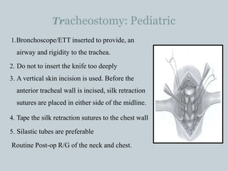 Tracheostomy: Pediatric
1.Bronchoscope/ETT inserted to provide, an
airway and rigidity to the trachea.
2. Do not to insert the knife too deeply
3. A vertical skin incision is used. Before the
anterior tracheal wall is incised, silk retraction
sutures are placed in either side of the midline.
4. Tape the silk retraction sutures to the chest wall
5. Silastic tubes are preferable
Routine Post-op R/G of the neck and chest.
 
