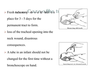  Fresh tracheostomyCshaorueldob
e
fl
e
tf
hti
en tube
place for 3 - 5 days for the
permanent tract to form.
 loss of the tracheal opening into the
neck wound, disastrous
consequences.
 A tube in an infant should not be
changed for the first time without a
bronchoscope on hand.
 
