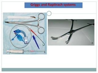 Griggs and Rapitrach systems
 
