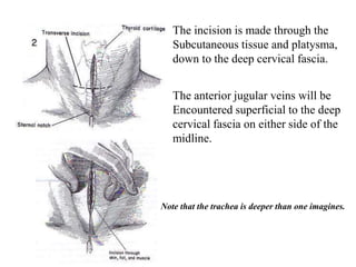 The incision is made through the
Subcutaneous tissue and platysma,
down to the deep cervical fascia.
The anterior jugular veins will be
Encountered superficial to the deep
cervical fascia on either side of the
midline.
Note that the trachea is deeper than one imagines.
 