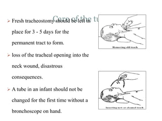 Care of the tube Fresh tracheostomy should be left in
place for 3 - 5 days for the
permanent tract to form.
 loss of the tracheal opening into the
neck wound, disastrous
consequences.
 A tube in an infant should not be
changed for the first time without a
bronchoscope on hand.
 