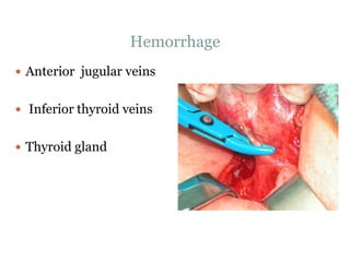 Hemorrhage
 Anterior jugular veins
 Inferior thyroid veins
 Thyroid gland
 