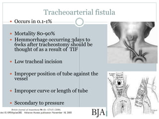 Tracheoarterial fistula
 Occurs in 0.1-1%
 Mortality 80-90%
 Hemmorrhage occurring 3days to
6wks after tracheostomy should be
thought of as a result of TIF
 Low tracheal incision
 Improper position of tube against the
vessel
 Improper curve or length of tube
 Secondary to pressure
 