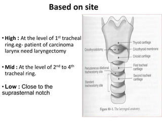 Based on site
• High : At the level of 1st tracheal
ring.eg- patient of carcinoma
larynx need laryngectomy
• Mid : At the level of 2nd to 4th
tracheal ring.
• Low : Close to the
suprasternal notch
 