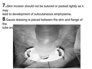 7.Skin incision should not be sutured or packed tightly as it
may
lead to development of subcutaneous emphysema.
8.Gauze dressing is placed between the skin and flange of
the
tube around the stoma
 