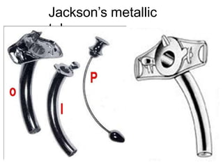 Jackson’s metallic
tube
 