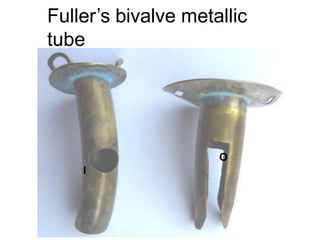 Fuller’s bivalve metallic
tube
I
O
 