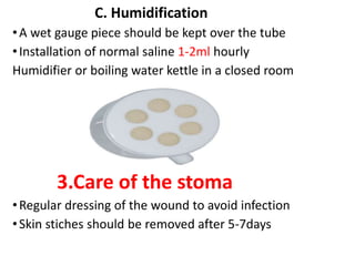C. Humidification
•A wet gauge piece should be kept over the tube
•Installation of normal saline 1-2ml hourly
Humidifier or boiling water kettle in a closed room
3.Care of the stoma
•Regular dressing of the wound to avoid infection
•Skin stiches should be removed after 5-7days
 