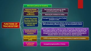 Tracheostomy | PPTX