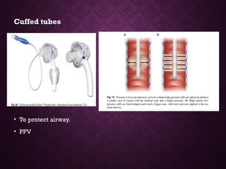 Cuffed tubes
• To protect airway.
• PPV
 