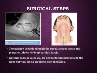 SURGICAL STEPS
• The incision is made through the subcutaneous tissue and
platysma , down to deep cervical fascia.
• Anterior jugular veins will be encountered superficial to the
deep cervical fascia on either side of midline.
 