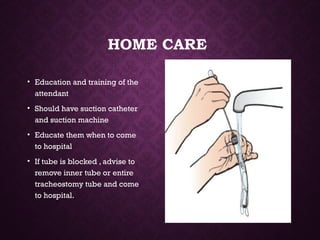 HOME CARE
• Education and training of the
attendant
• Should have suction catheter
and suction machine
• Educate them when to come
to hospital
• If tube is blocked , advise to
remove inner tube or entire
tracheostomy tube and come
to hospital.
 